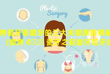 烤瓷牙前磨牙的三大关键原因揭秘(做烤 🐝 瓷牙之前磨牙后牙齿酸痛咬不了东西正常吗)